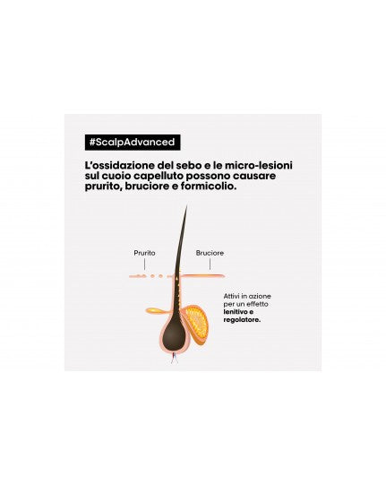 L'Oréal Serie Expert Scalp Advanced Anti-Discomfort 300 Ml